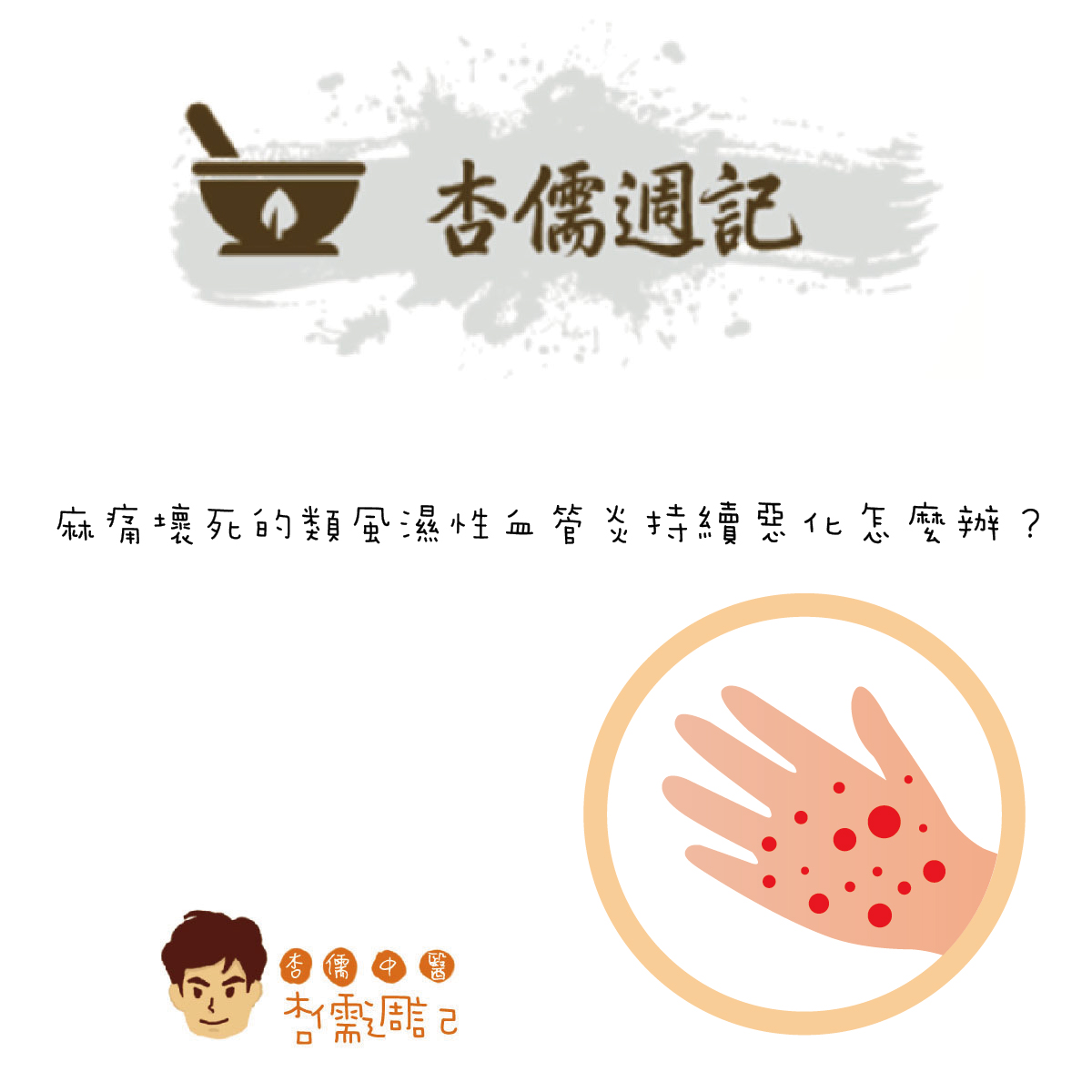 麻痛壞死的類風濕性血管炎，真難纏！